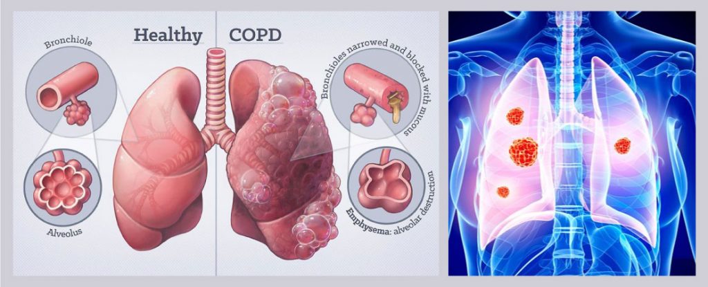 Indoor Air Pollutants and Related Human Health Hazards - My Fresh Air